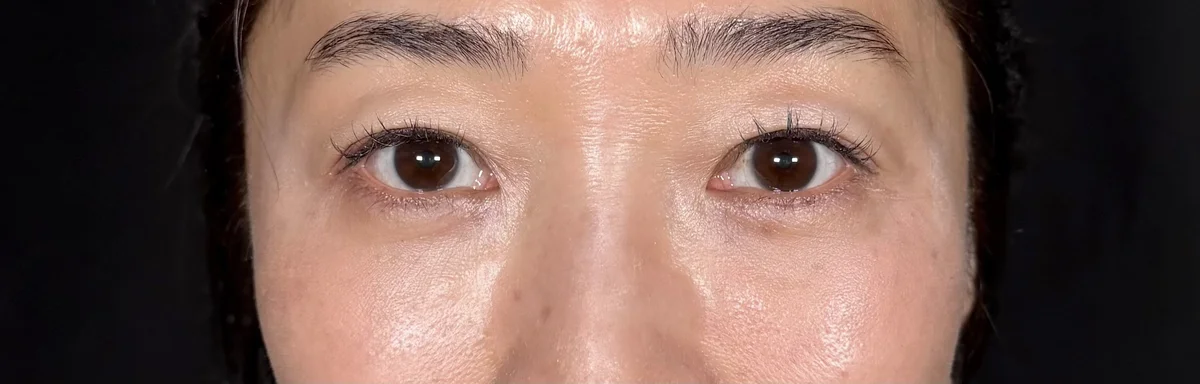 1ヶ月後