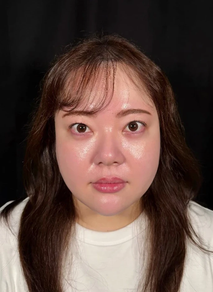 1ヶ月後