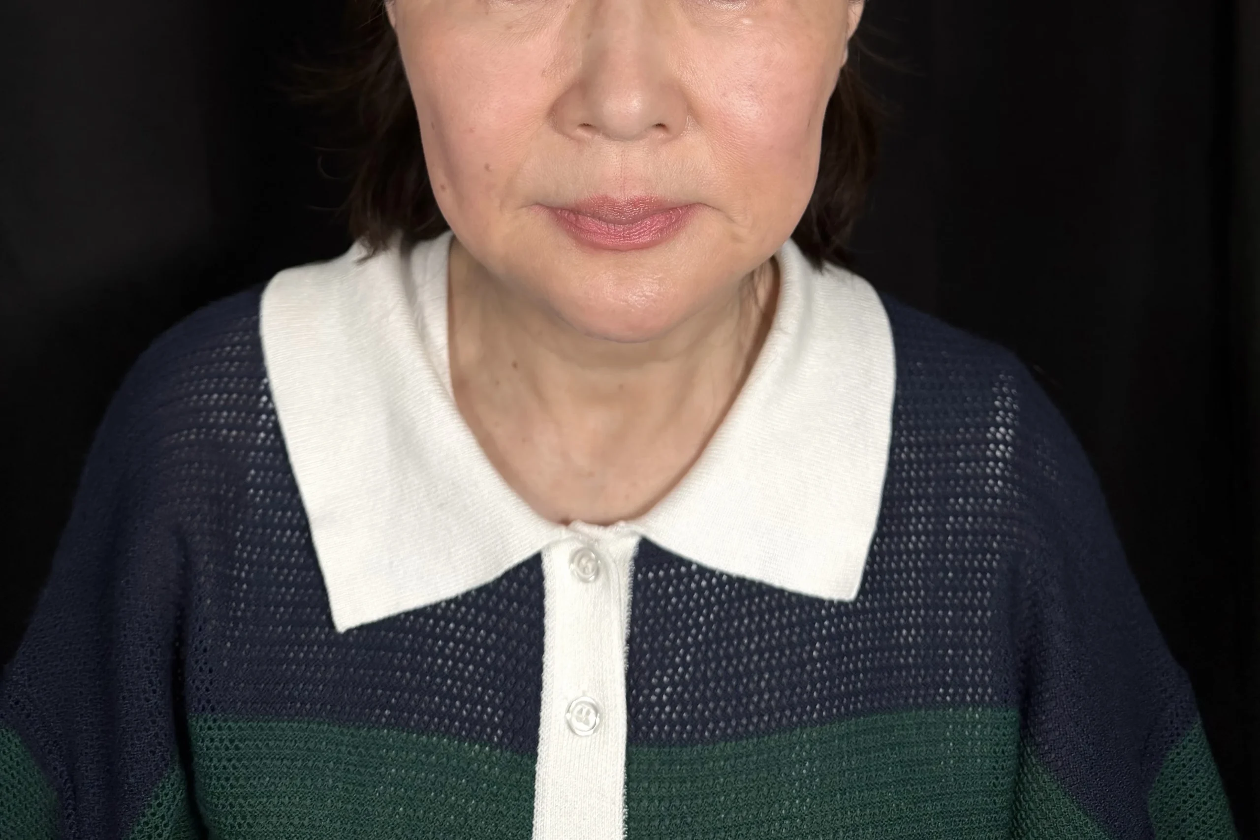 術前
